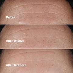 Clinique Smart Clinical Repair Wrinkle Correcting Face Serum With Hyaluronic Acid, Peptides + Advanced Retinoid Serum | Anti-Aging + Hydrating