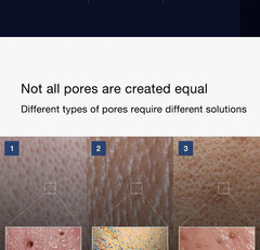 Medicube - Zero Pore One-day Serum - Serum for Dilated Pores with Acids - 50ml