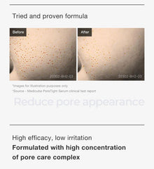 Medicube - Zero Pore One-day Serum - Serum for Dilated Pores with Acids - 50ml