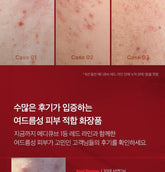 medicube - Red Serum 2.0