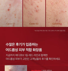 medicube - Red Serum 2.0