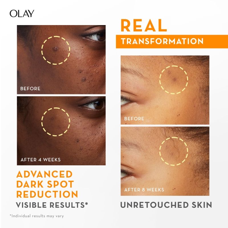 Olay Vitamin C Super Serum With 99% Pure Niacinamide - 30mL
