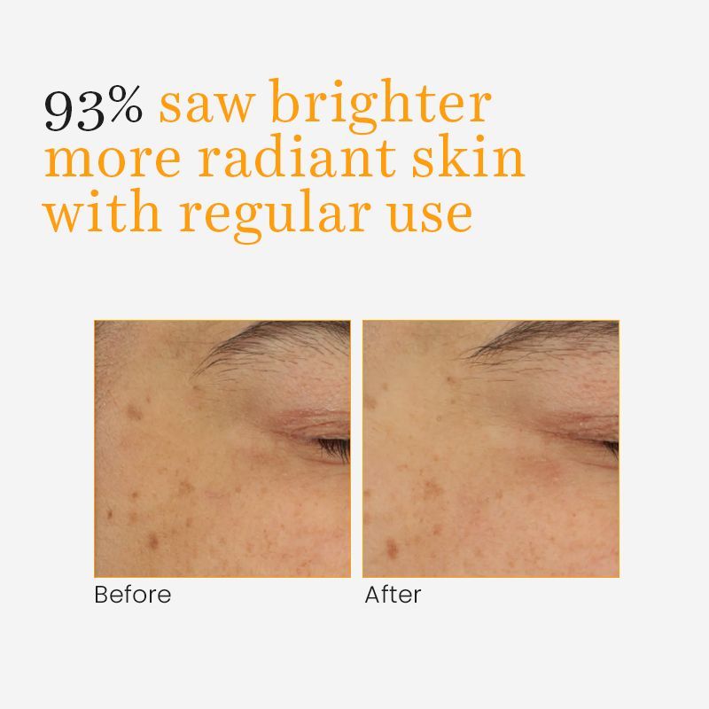 O3+ Vitamin C & Turmeric Glow Gel Cream Turmeric + Rosemary - 50gm